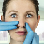 rhinoplasty plastic surgery